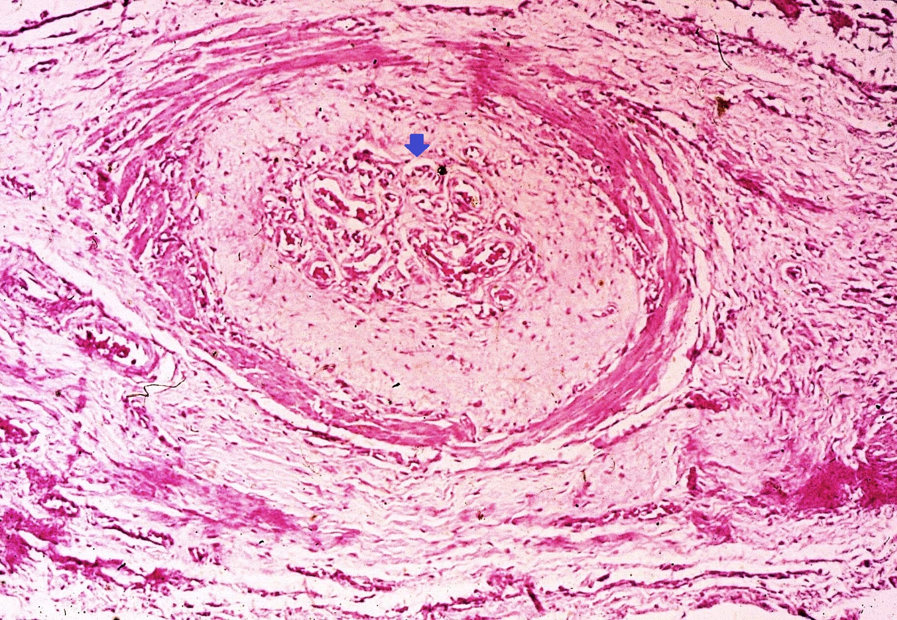 Alteraciones Hemodin Micas Patologia General